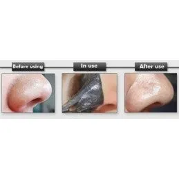 Black Mask – Máscara Preta Pontos Negros e Acne